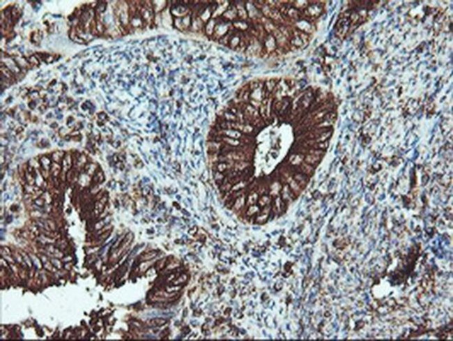 ATG3 Antibody in Immunohistochemistry (Paraffin) (IHC (P))