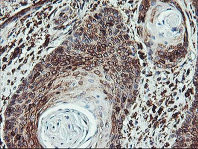 ATG3 Antibody in Immunohistochemistry (Paraffin) (IHC (P))