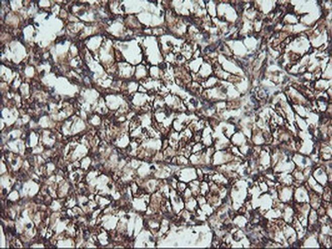 ATG3 Antibody in Immunohistochemistry (Paraffin) (IHC (P))