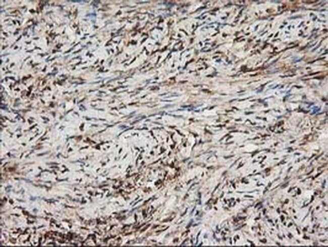 Nudel Antibody in Immunohistochemistry (Paraffin) (IHC (P))