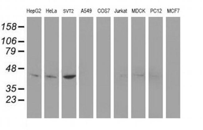 Nudel Antibody in Western Blot (WB)