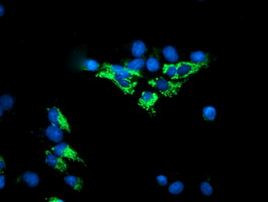 DLD Antibody in Immunocytochemistry (ICC/IF)