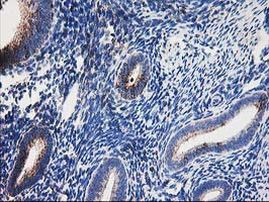 DLD Antibody in Immunohistochemistry (Paraffin) (IHC (P))