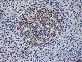 DLD Antibody in Immunohistochemistry (Paraffin) (IHC (P))