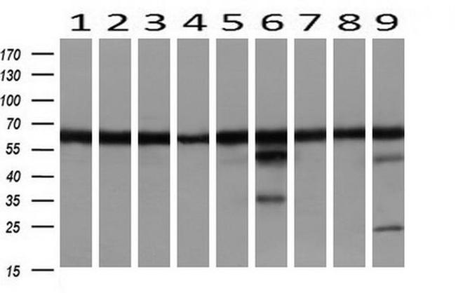 DLD Antibody in Western Blot (WB)