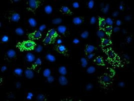 DLD Antibody in Immunocytochemistry (ICC/IF)