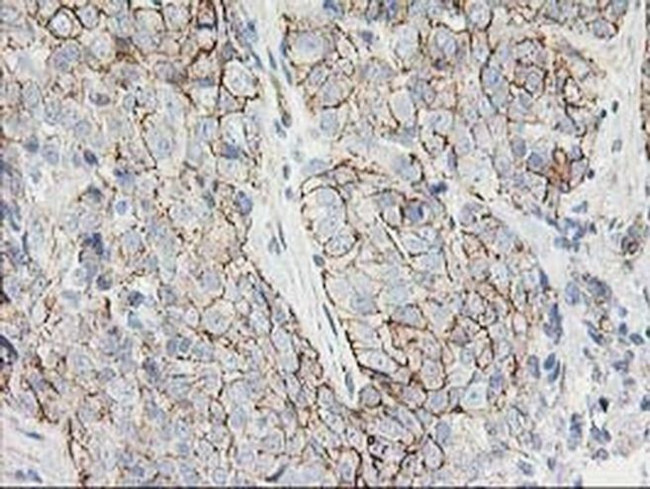 ANAPC2 Antibody in Immunohistochemistry (Paraffin) (IHC (P))