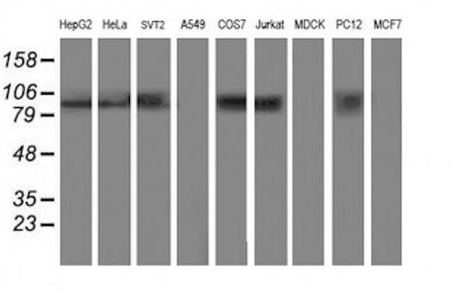 ANAPC2 Antibody in Western Blot (WB)