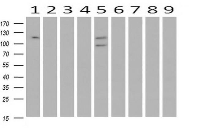 ANAPC2 Antibody in Western Blot (WB)