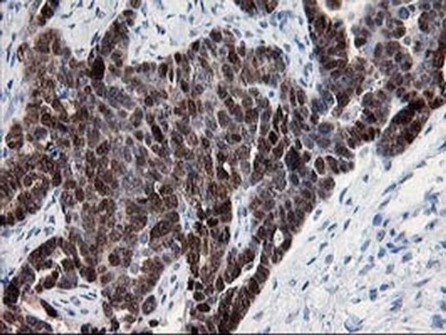 HSPBP1 Antibody in Immunohistochemistry (Paraffin) (IHC (P))