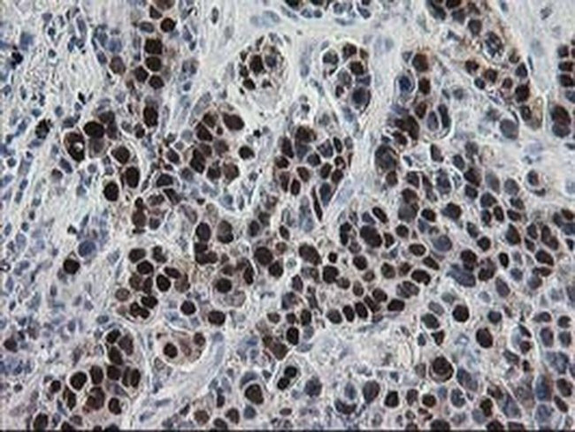 HSPBP1 Antibody in Immunohistochemistry (Paraffin) (IHC (P))