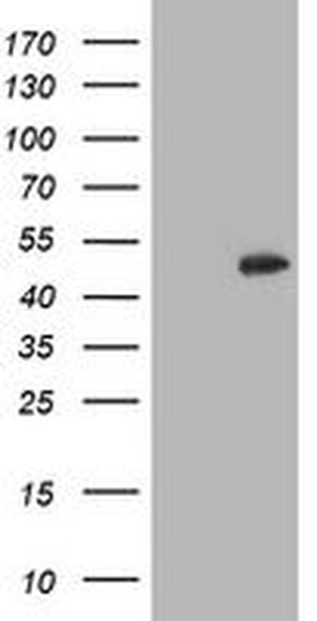 CCM2 Antibody in Western Blot (WB)