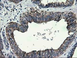 CCM2 Antibody in Immunohistochemistry (Paraffin) (IHC (P))