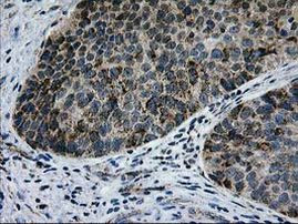 CCM2 Antibody in Immunohistochemistry (Paraffin) (IHC (P))