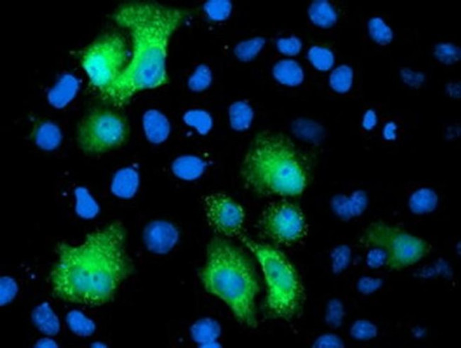 PGAM2 Antibody in Immunocytochemistry (ICC/IF)