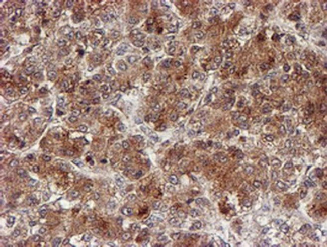 CYP17A1 Antibody in Immunohistochemistry (Paraffin) (IHC (P))