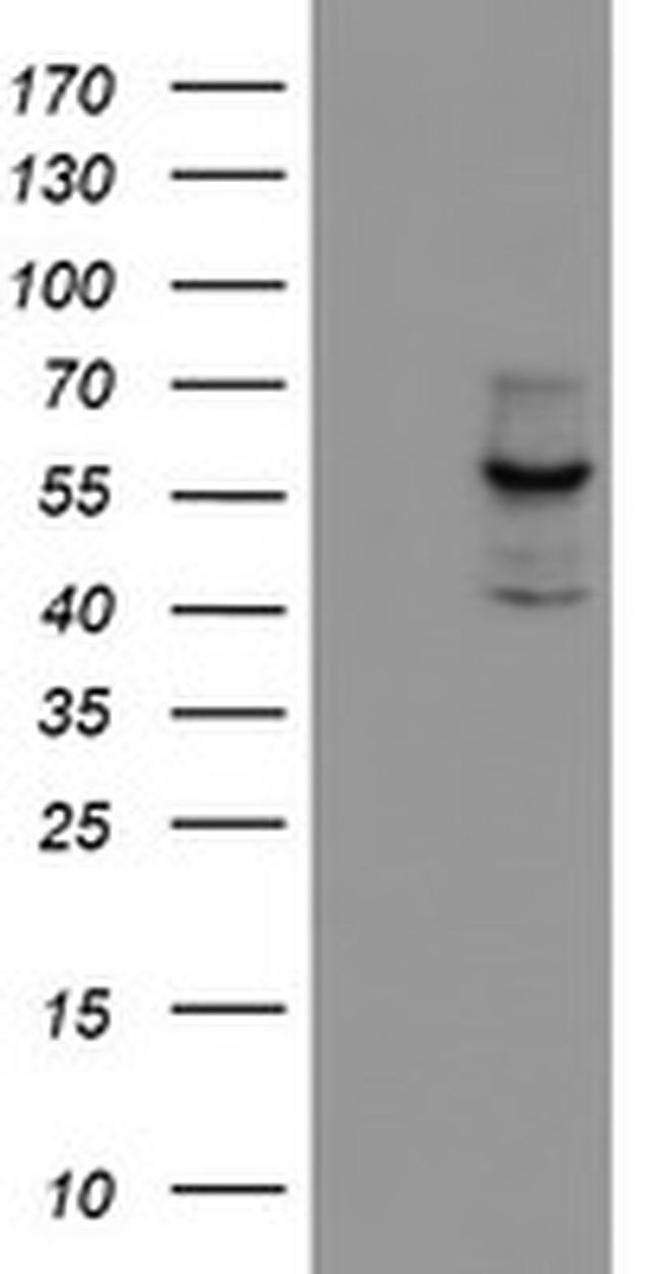 CYP17A1 Antibody in Western Blot (WB)