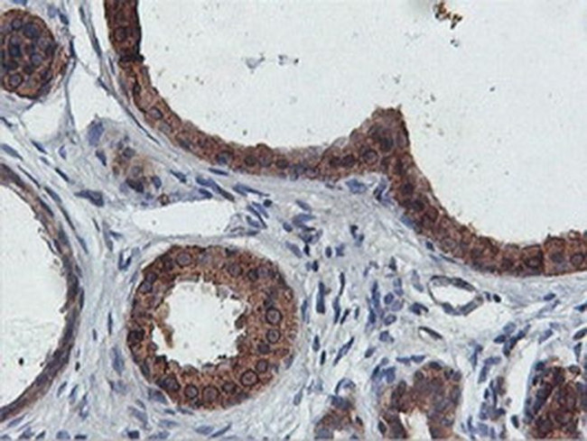 FDFT1 Antibody in Immunohistochemistry (Paraffin) (IHC (P))