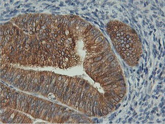 FDFT1 Antibody in Immunohistochemistry (Paraffin) (IHC (P))