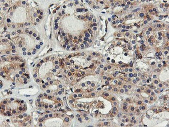 FDFT1 Antibody in Immunohistochemistry (Paraffin) (IHC (P))