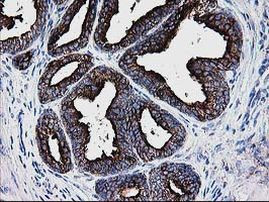 DTYMK Antibody in Immunohistochemistry (Paraffin) (IHC (P))