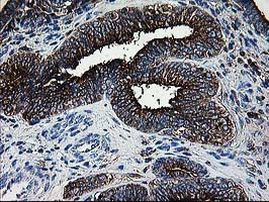 DTYMK Antibody in Immunohistochemistry (Paraffin) (IHC (P))