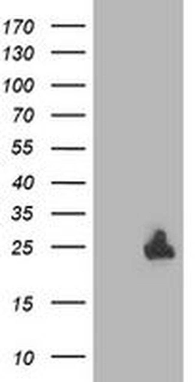 DTYMK Antibody in Western Blot (WB)