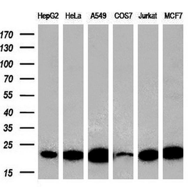 DTYMK Antibody in Western Blot (WB)