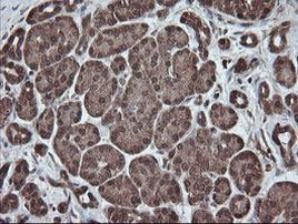 PNPO Antibody in Immunohistochemistry (Paraffin) (IHC (P))