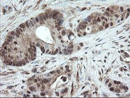 PNPO Antibody in Immunohistochemistry (Paraffin) (IHC (P))