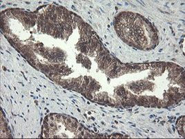 PNPO Antibody in Immunohistochemistry (Paraffin) (IHC (P))