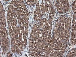 PNPO Antibody in Immunohistochemistry (Paraffin) (IHC (P))