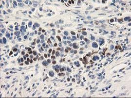 UNG Antibody in Immunohistochemistry (Paraffin) (IHC (P))