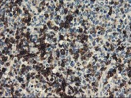 UNG Antibody in Immunohistochemistry (Paraffin) (IHC (P))