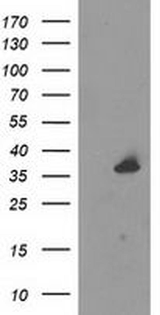 UNG Antibody in Western Blot (WB)