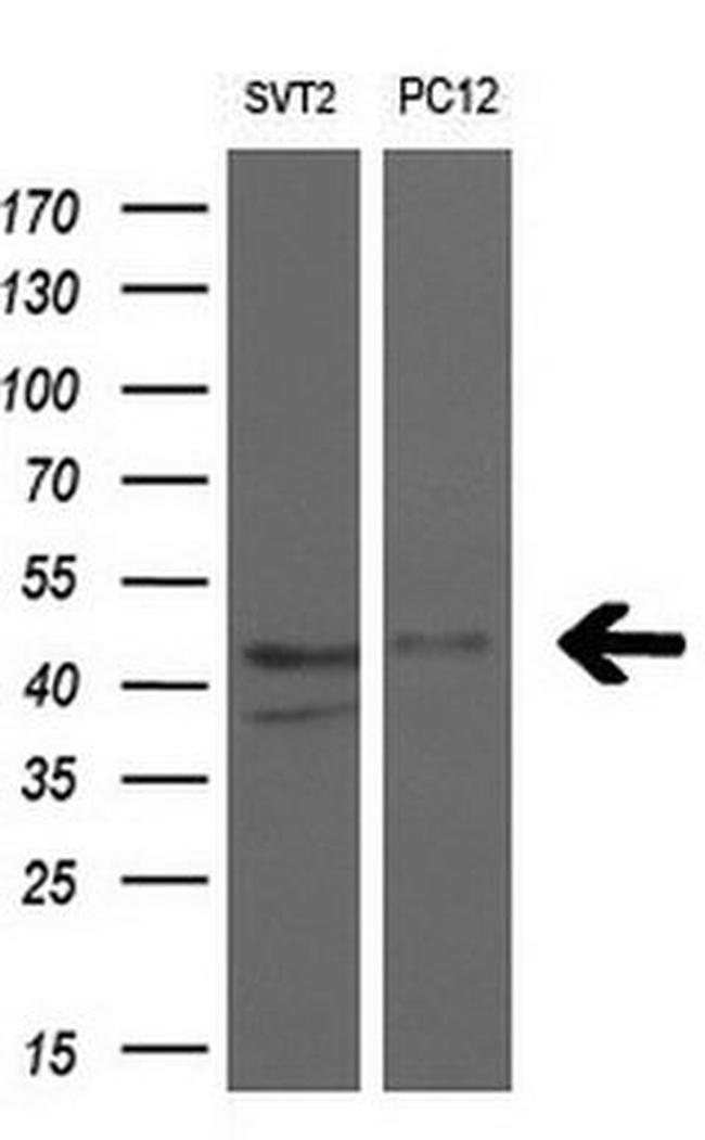 RAD51B Antibody in Western Blot (WB)