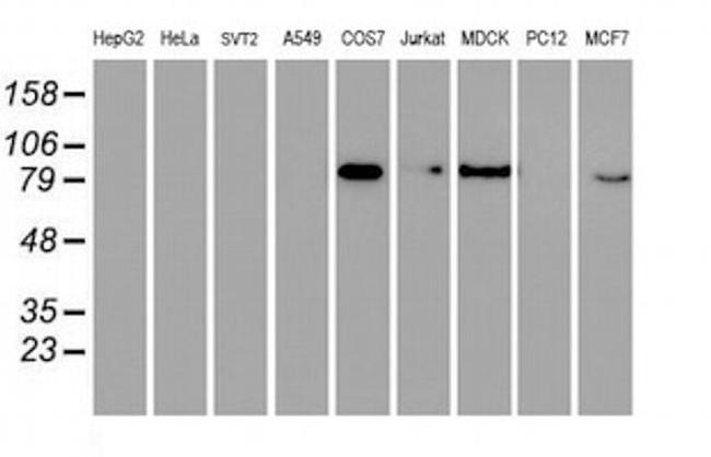 GTF2F1 Antibody in Western Blot (WB)