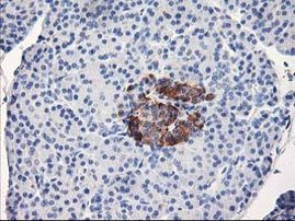 ACSS2 Antibody in Immunohistochemistry (Paraffin) (IHC (P))