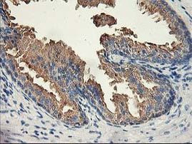 ACSS2 Antibody in Immunohistochemistry (Paraffin) (IHC (P))