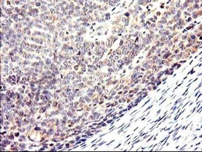 CYP2J2 Antibody in Immunohistochemistry (Paraffin) (IHC (P))