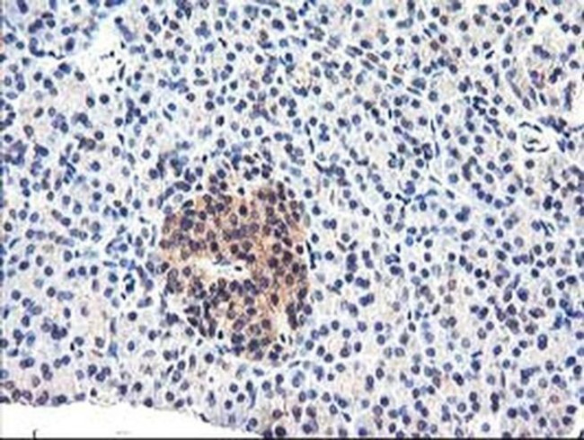 CYP2J2 Antibody in Immunohistochemistry (Paraffin) (IHC (P))