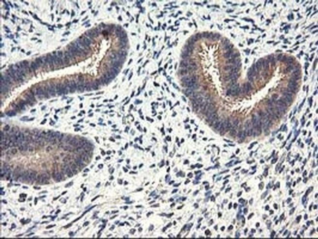 CYP2J2 Antibody in Immunohistochemistry (Paraffin) (IHC (P))