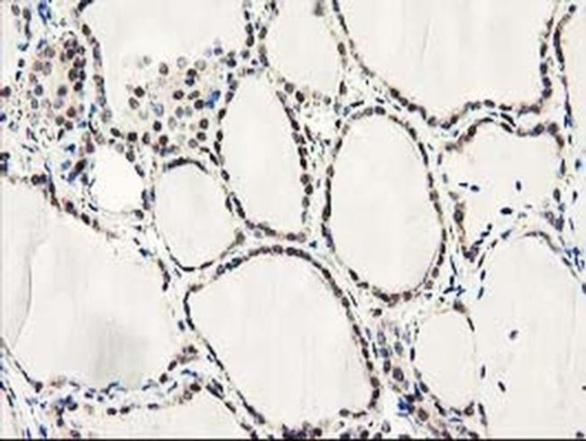 Latexin Antibody in Immunohistochemistry (Paraffin) (IHC (P))