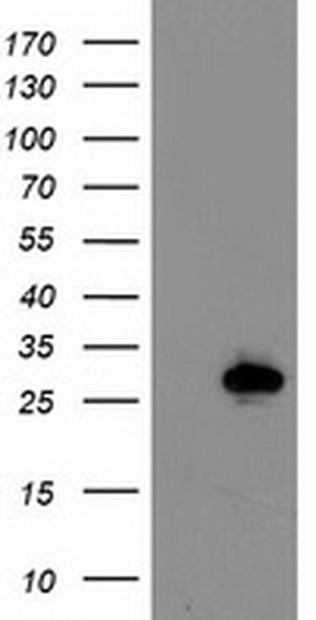 Latexin Antibody in Western Blot (WB)