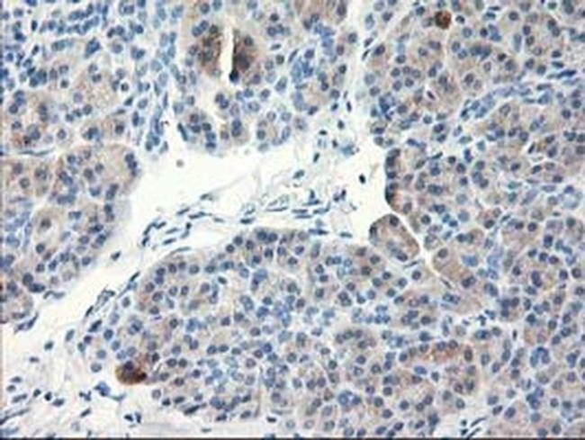 TBC1D21 Antibody in Immunohistochemistry (Paraffin) (IHC (P))