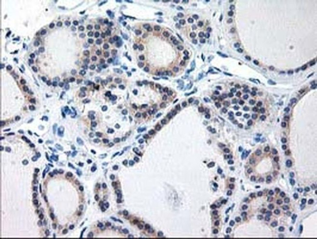 TBC1D21 Antibody in Immunohistochemistry (Paraffin) (IHC (P))