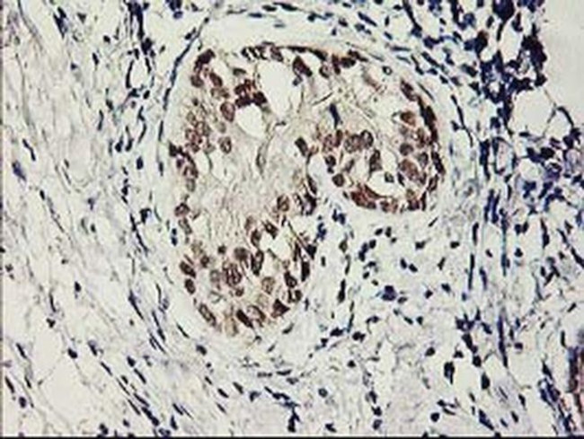 SERPINB13 Antibody in Immunohistochemistry (Paraffin) (IHC (P))