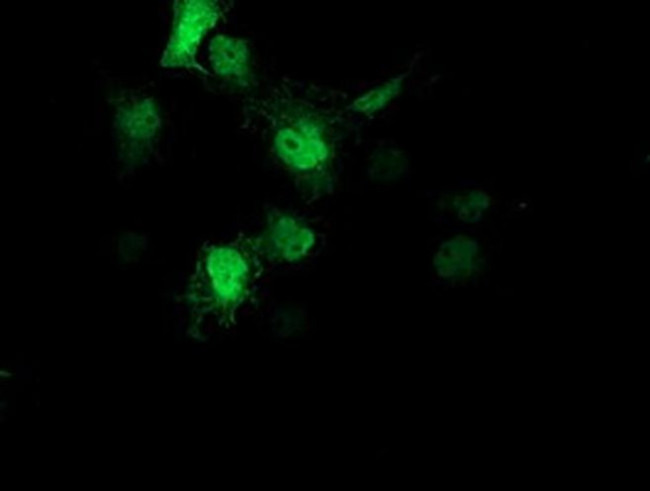 AIPL1 Antibody in Immunocytochemistry (ICC/IF)