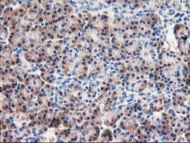 AIPL1 Antibody in Immunohistochemistry (Paraffin) (IHC (P))