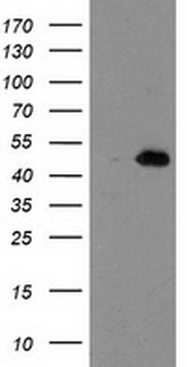 AIPL1 Antibody in Western Blot (WB)